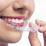 woman smiling with Invisalign retainer in her hand