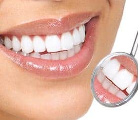 image of woman smiling and a dental mirror upside down showing reflection of her teeth